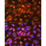 Immunofluorescence - Anti-LRPAP1 Antibody (A89845) - Antibodies.com