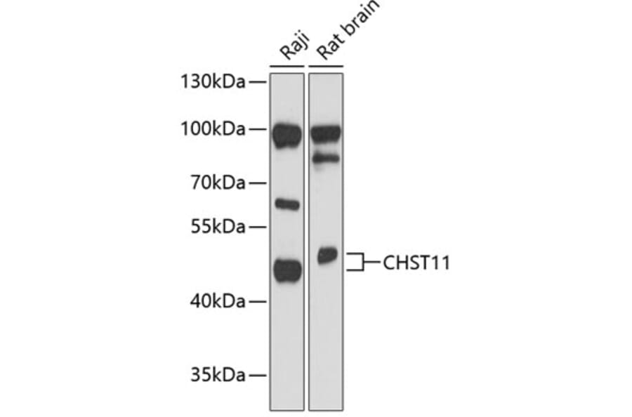 Western Blot - Anti-CHST11 Antibody (A89846) - Antibodies.com