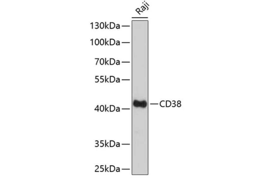 Western Blot - Anti-CD38 Antibody (A89847) - Antibodies.com