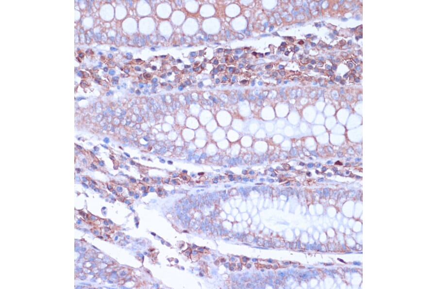 Immunohistochemistry - Anti-CD38 Antibody (A89847) - Antibodies.com