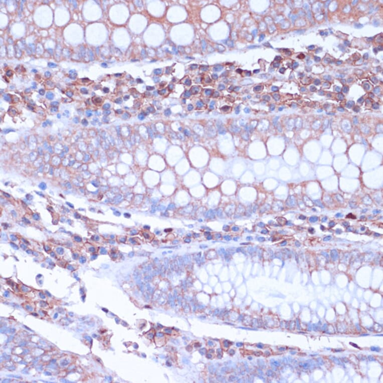 Immunohistochemistry - Anti-CD38 Antibody (A89847) - Antibodies.com