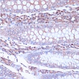 Immunohistochemistry - Anti-CD38 Antibody (A89847) - Antibodies.com