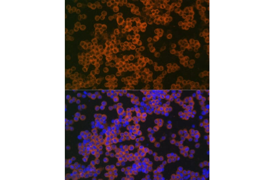 Immunofluorescence - Anti-CD38 Antibody (A89847) - Antibodies.com