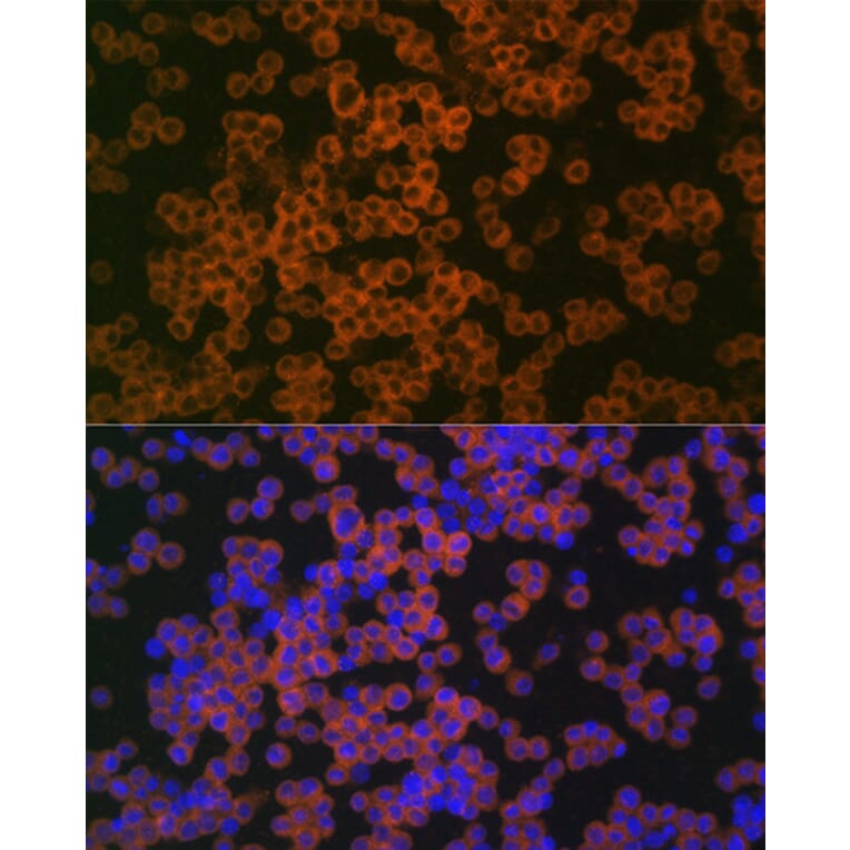 Immunofluorescence - Anti-CD38 Antibody (A89847) - Antibodies.com