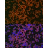 Immunofluorescence - Anti-CD38 Antibody (A89847) - Antibodies.com