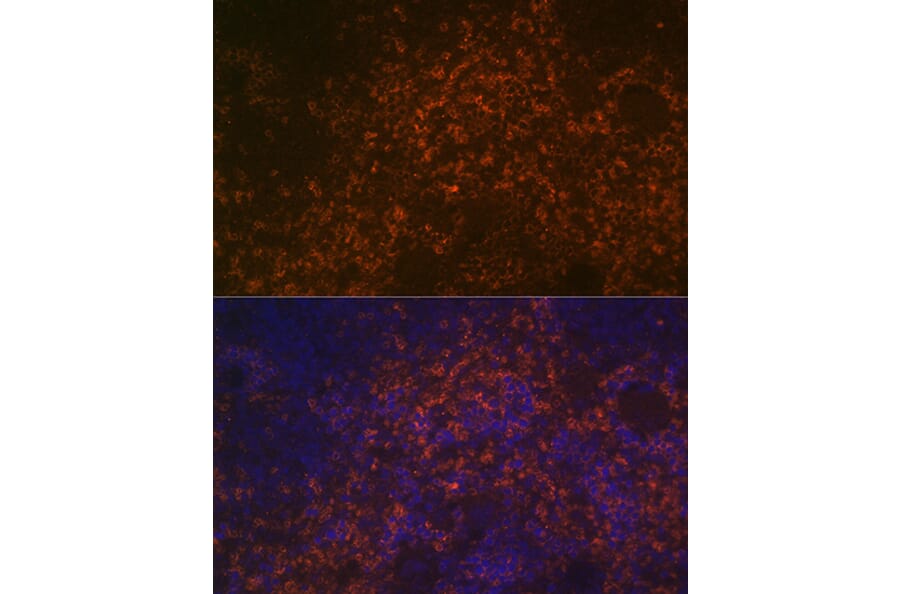Immunofluorescence - Anti-CD38 Antibody (A89847) - Antibodies.com