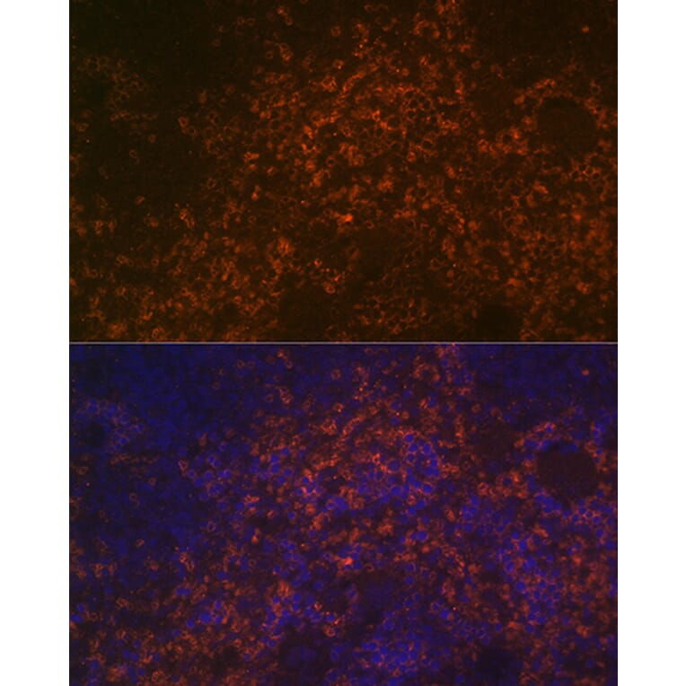 Immunofluorescence - Anti-CD38 Antibody (A89847) - Antibodies.com