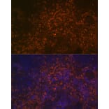 Immunofluorescence - Anti-CD38 Antibody (A89847) - Antibodies.com