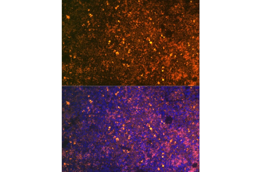 Immunofluorescence - Anti-CD38 Antibody (A89847) - Antibodies.com