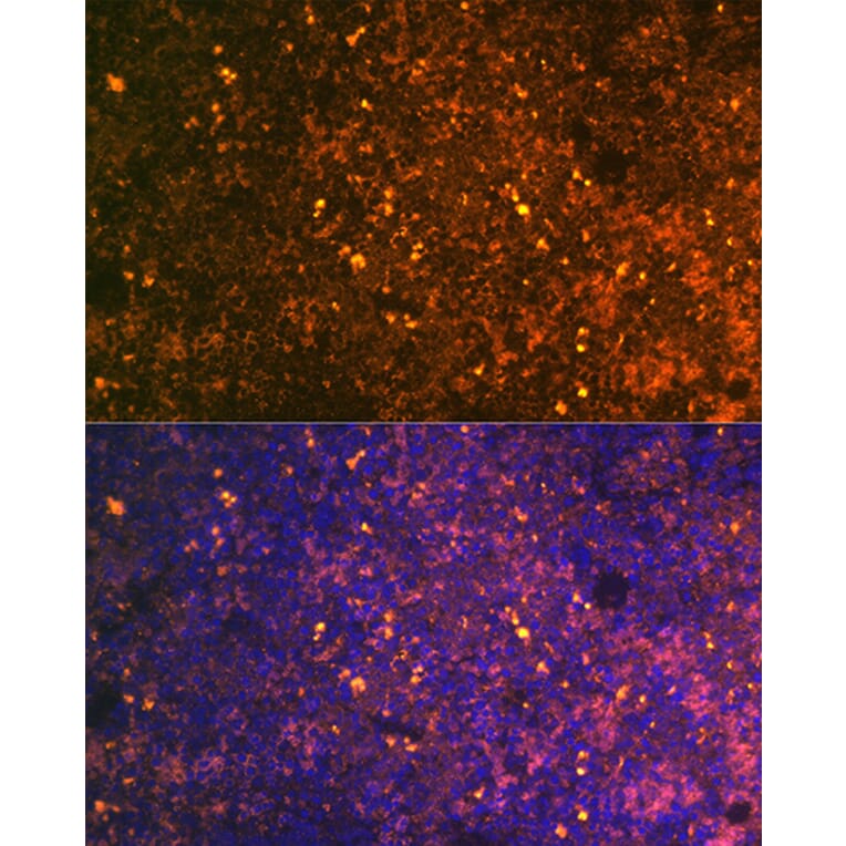 Immunofluorescence - Anti-CD38 Antibody (A89847) - Antibodies.com