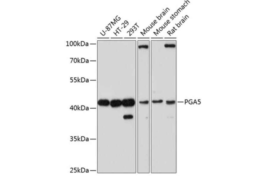 Western Blot - Anti-PGA5 Antibody (A89848) - Antibodies.com