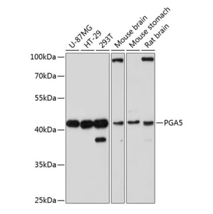 Western Blot - Anti-PGA5 Antibody (A89848) - Antibodies.com