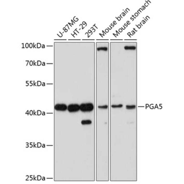 Western Blot - Anti-PGA5 Antibody (A89848) - Antibodies.com