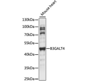 Western Blot - Anti-B3GALT4 Antibody (A89849) - Antibodies.com