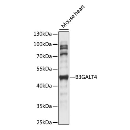 Western Blot - Anti-B3GALT4 Antibody (A89849) - Antibodies.com