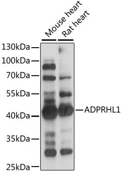Western blot analysis of extracts of various cell lines, using Anti-ADPRHL1 Antibody (A15553) at 1:1,000 dilution.
Secondary antibody: Goat Anti-Rabbit IgG (H+L) (HRP) (AS014) at 1:10,000 dilution.
Lysates / proteins: 25µg per lane.
Blocking buffer: 3% non-fat dry milk in TBST.
Detection: ECL Enhanced Kit (RM00021).
Exposure time: 3s.