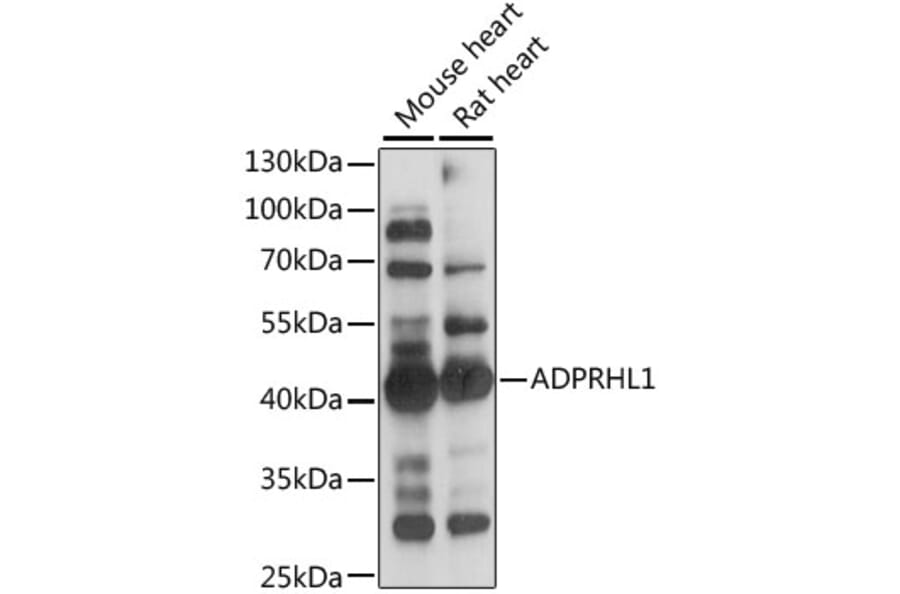 Western Blot - Anti-ADPRHL1 Antibody (A89850) - Antibodies.com