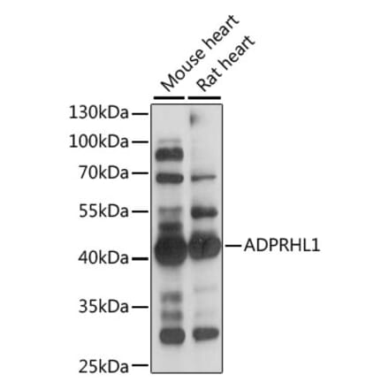 Western Blot - Anti-ADPRHL1 Antibody (A89850) - Antibodies.com