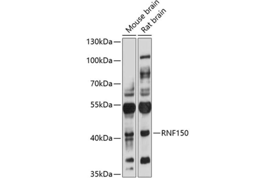 Western Blot - Anti-RNF150 Antibody (A3472) - Antibodies.com