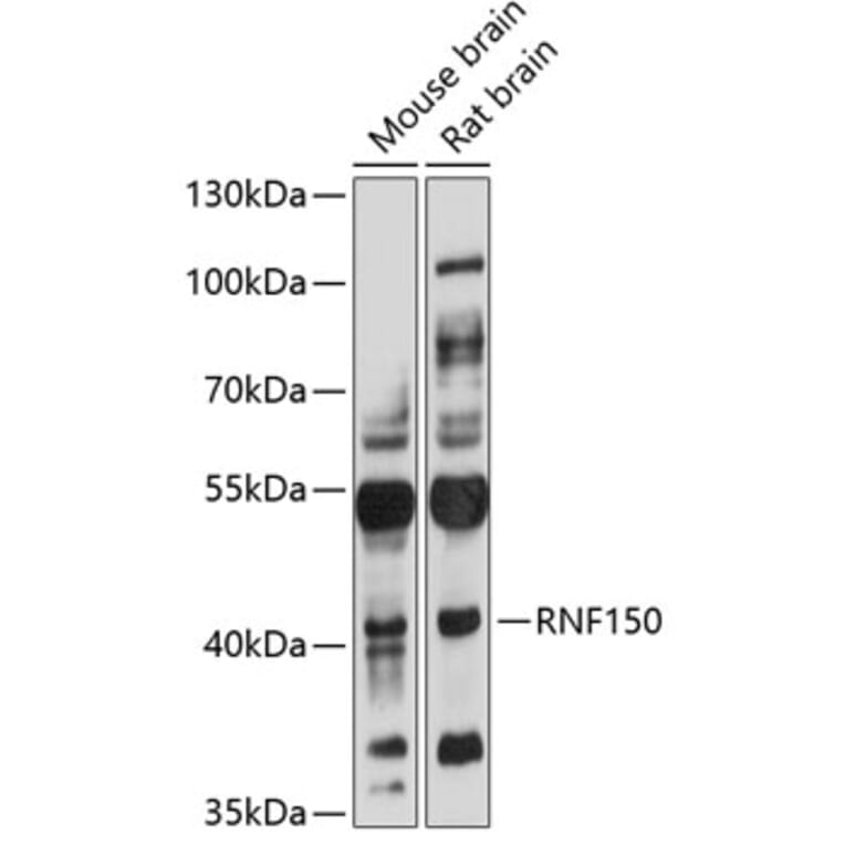 Western Blot - Anti-RNF150 Antibody (A3472) - Antibodies.com