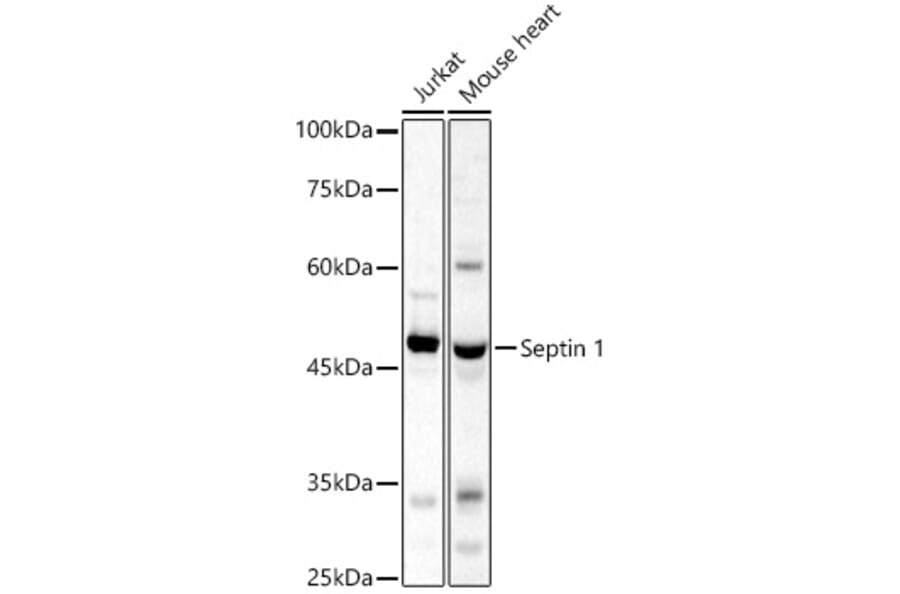 Western Blot - Anti-LARP Antibody (A89852) - Antibodies.com