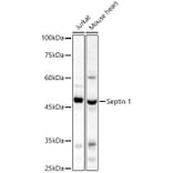 Western Blot - Anti-LARP Antibody (A89852) - Antibodies.com