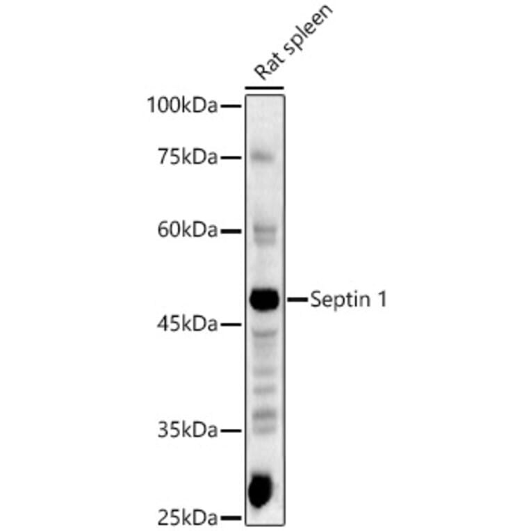 Western Blot - Anti-LARP Antibody (A89852) - Antibodies.com