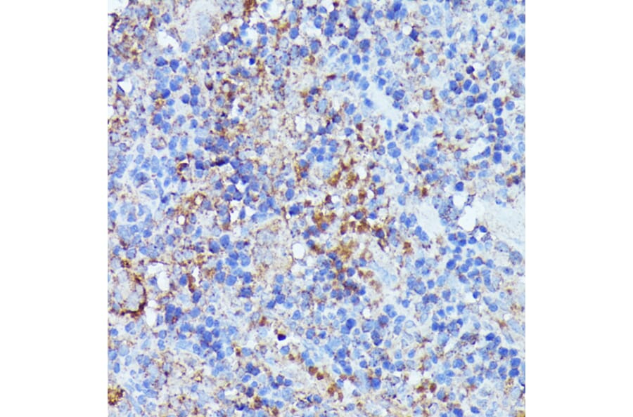 Immunohistochemistry - Anti-LARP Antibody (A89852) - Antibodies.com