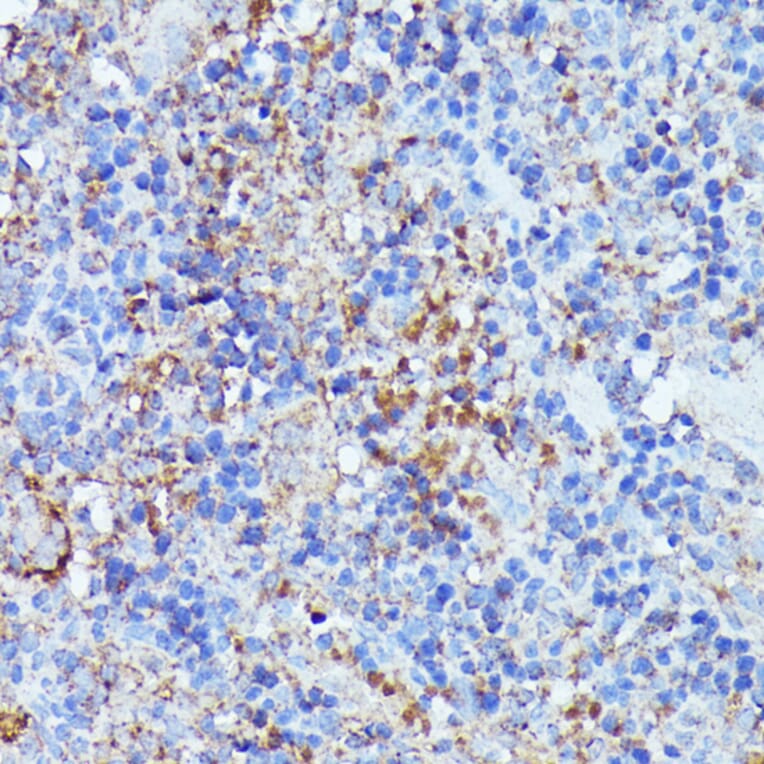 Immunohistochemistry - Anti-LARP Antibody (A89852) - Antibodies.com