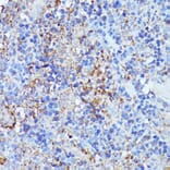 Immunohistochemistry - Anti-LARP Antibody (A89852) - Antibodies.com