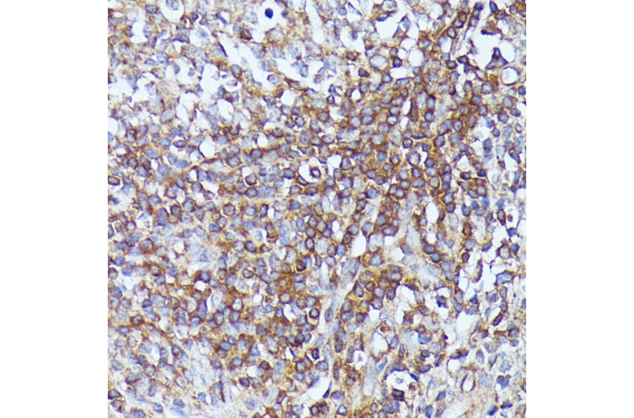 Immunohistochemistry - Anti-LARP Antibody (A89852) - Antibodies.com