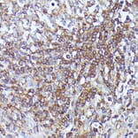 Immunohistochemistry - Anti-LARP Antibody (A89852) - Antibodies.com