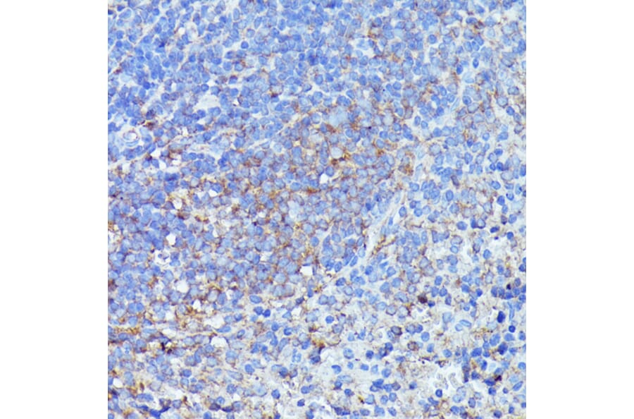 Immunohistochemistry - Anti-LARP Antibody (A89852) - Antibodies.com
