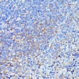 Immunohistochemistry - Anti-LARP Antibody (A89852) - Antibodies.com