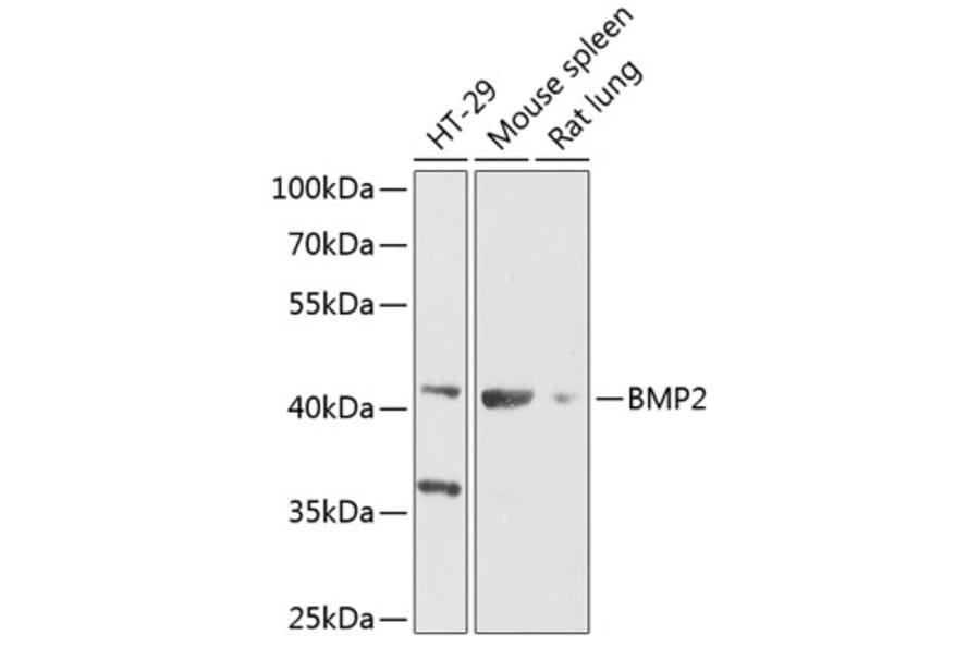 Western Blot - Anti-BMP2 Antibody (A89853) - Antibodies.com