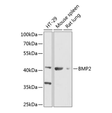 Western Blot - Anti-BMP2 Antibody (A89853) - Antibodies.com