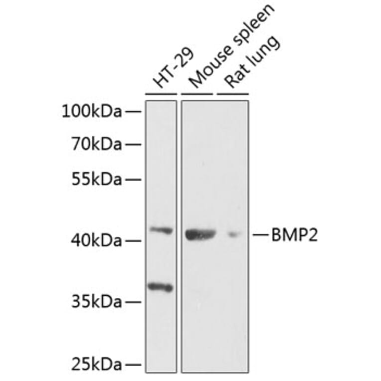 Western Blot - Anti-BMP2 Antibody (A89853) - Antibodies.com