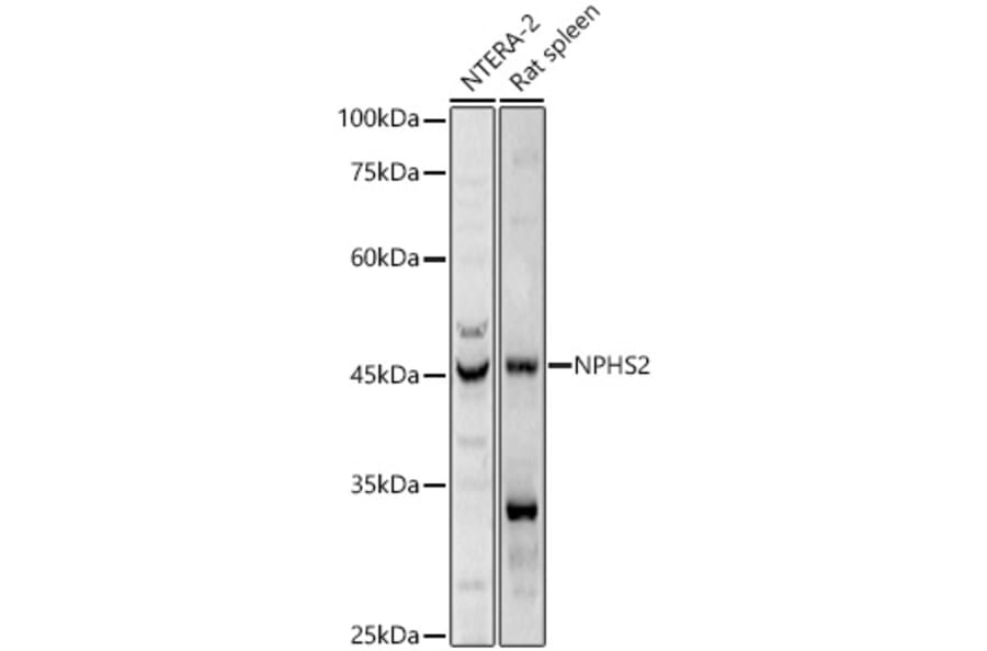 Western Blot - Anti-NPHS2 Antibody (A89854) - Antibodies.com