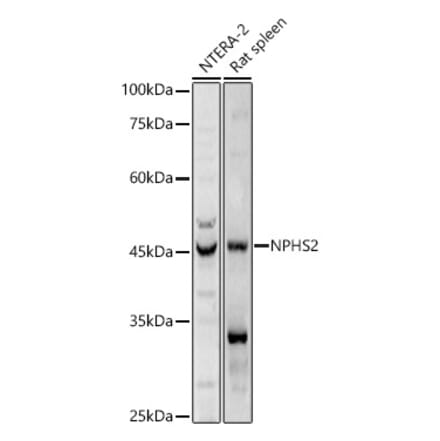 Western Blot - Anti-NPHS2 Antibody (A89854) - Antibodies.com