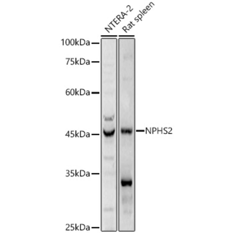 Western Blot - Anti-NPHS2 Antibody (A89854) - Antibodies.com