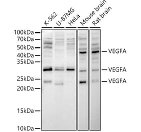 Western Blot - Anti-VEGFA Antibody (A89855) - Antibodies.com
