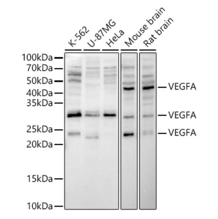 Western Blot - Anti-VEGFA Antibody (A89855) - Antibodies.com