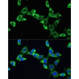 Immunofluorescence - Anti-VEGFA Antibody (A89855) - Antibodies.com