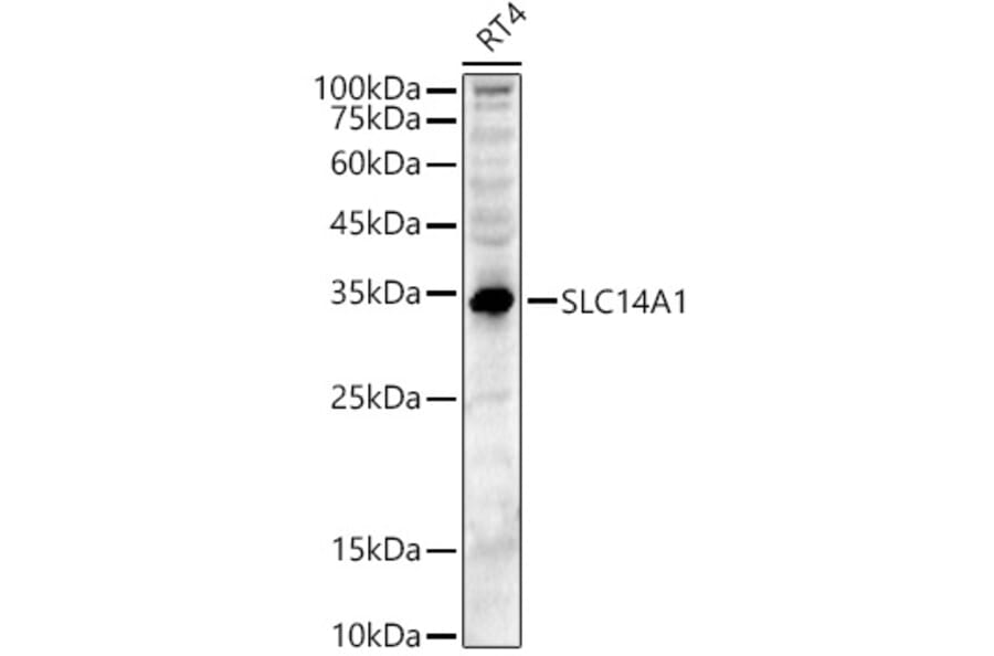 Western Blot - Anti-SLC14A1/UTE Antibody (A89857) - Antibodies.com