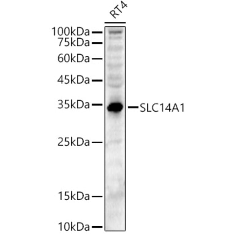 Western Blot - Anti-SLC14A1/UTE Antibody (A89857) - Antibodies.com