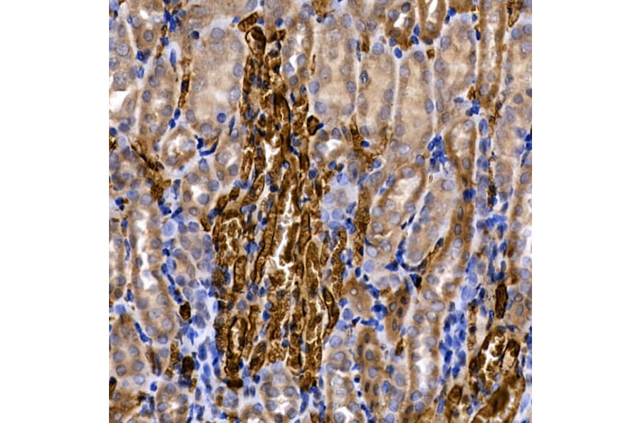 Immunohistochemistry - Anti-SLC14A1/UTE Antibody (A89857) - Antibodies.com