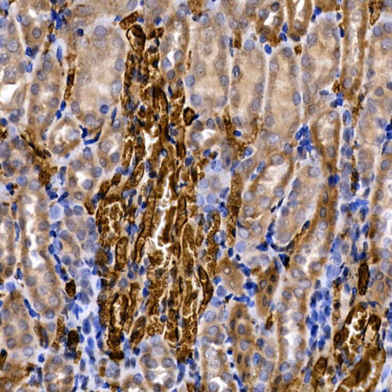 Immunohistochemistry - Anti-SLC14A1/UTE Antibody (A89857) - Antibodies.com