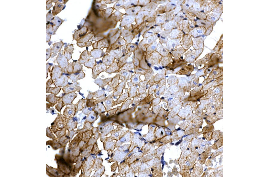 Immunohistochemistry - Anti-SLC14A1/UTE Antibody (A89857) - Antibodies.com