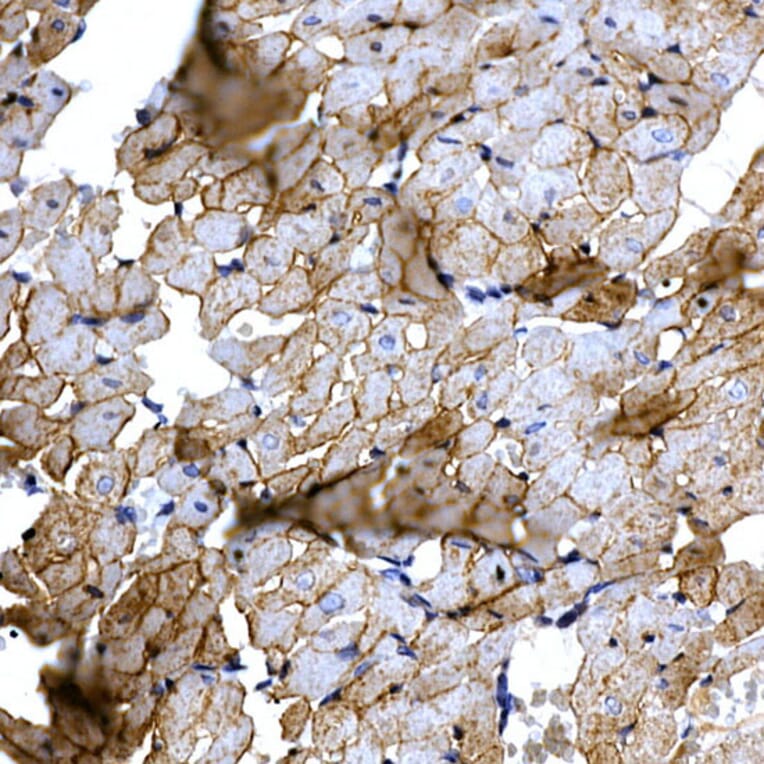 Immunohistochemistry - Anti-SLC14A1/UTE Antibody (A89857) - Antibodies.com