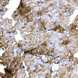 Immunohistochemistry - Anti-SLC14A1/UTE Antibody (A89857) - Antibodies.com